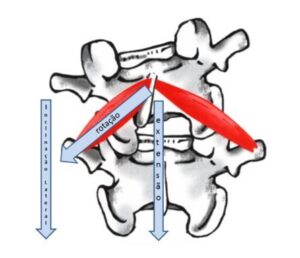 Desalinhamento vertebral - subluxação