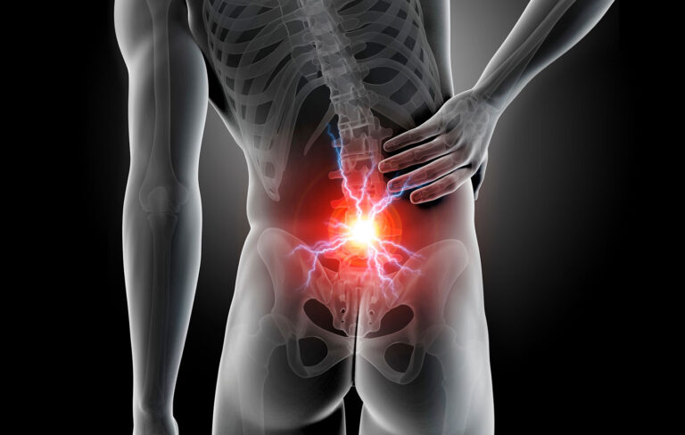 tratamento-hernia-de-disco-descompressao-vertebral-caxias-do-sul